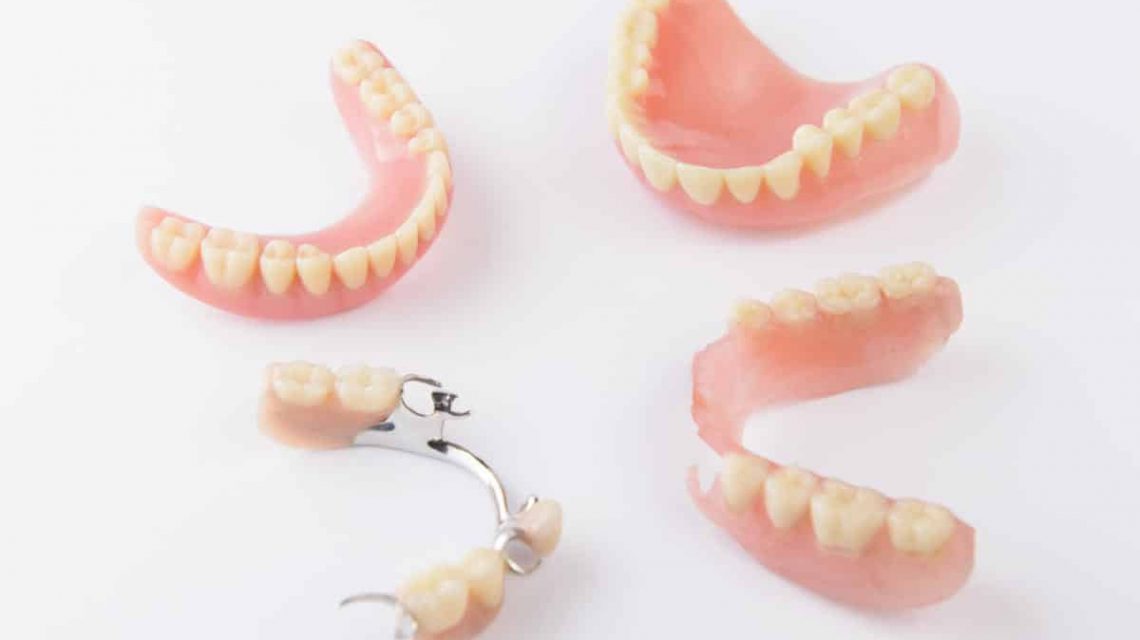 Bridges and Partial Dentures Green Lane Dental Clinic Dentist in